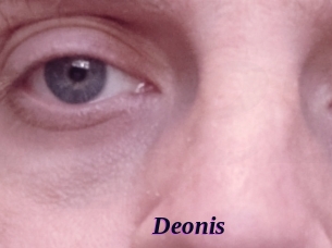 Deonis